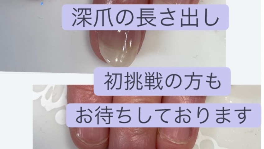 初めてのネイルサロンで深爪の長さだし