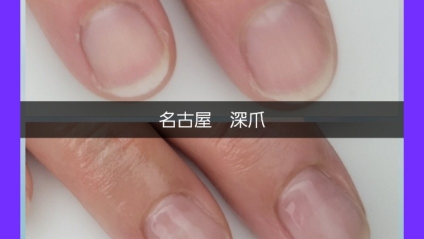 深爪コーティング3回目のお客様