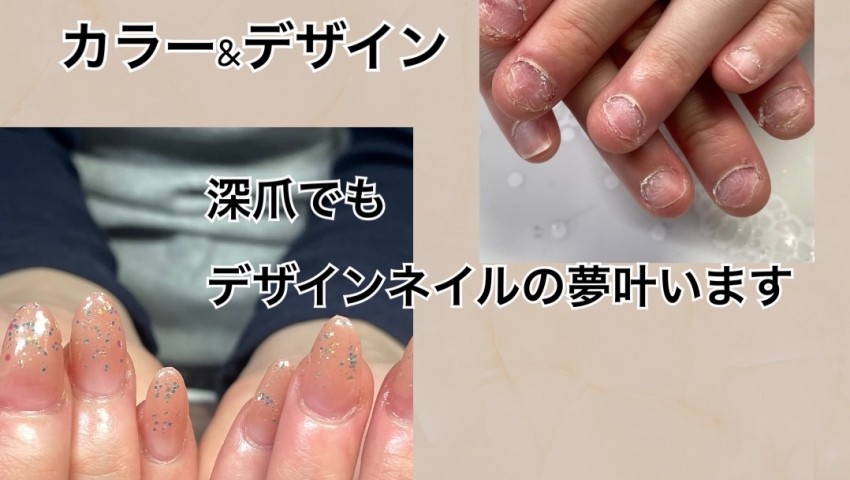 深爪+カラーデザインのお客様