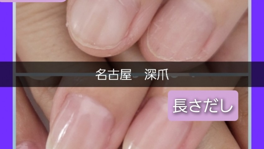 深爪長さだし