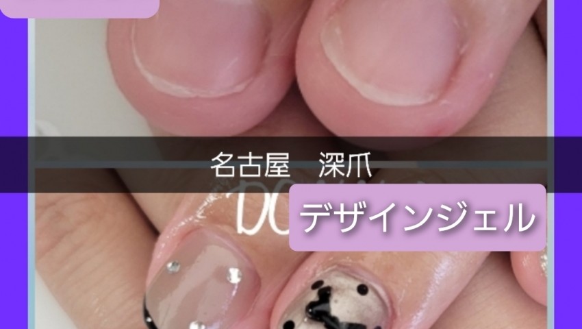 深爪　デザインジェル