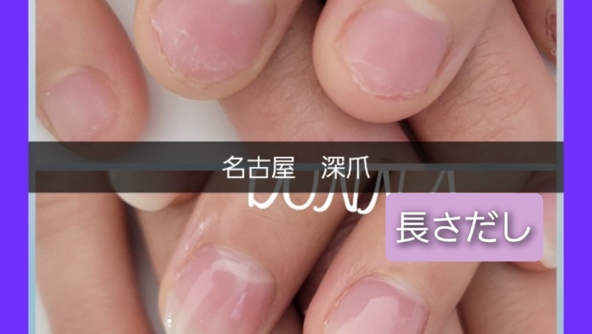 深爪　自然な長さだし