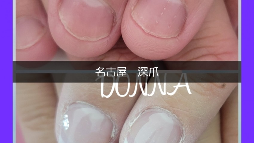 深爪+カラーのお客様