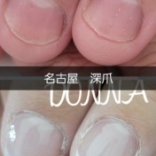 深爪+カラーのお客様