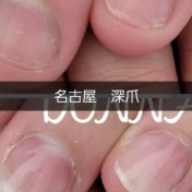 深爪自然な長さだしのお客様