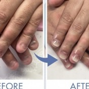 深爪に戻っても大丈夫！