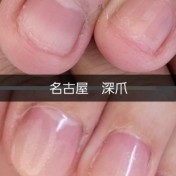 深爪長さだし+カラー