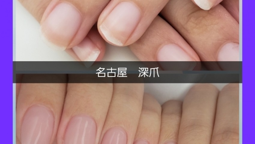 毎月のメンテナンスで美爪へ