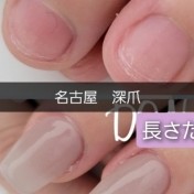 深爪　長さだし+カラー