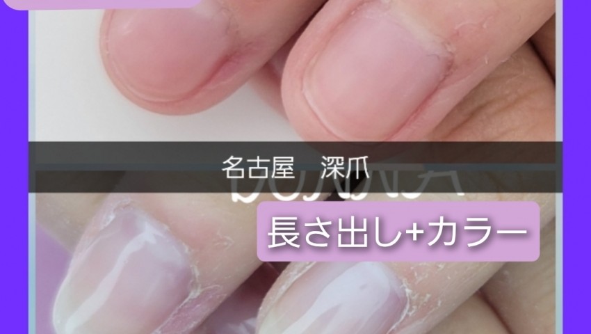 深爪ナチュラルな長さ出し+カラー